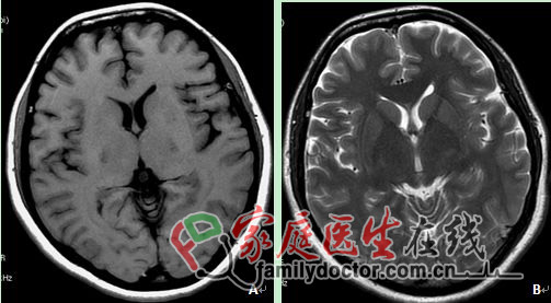 CT检查、X线检查等常用医学影像学检查方法的价值和局限